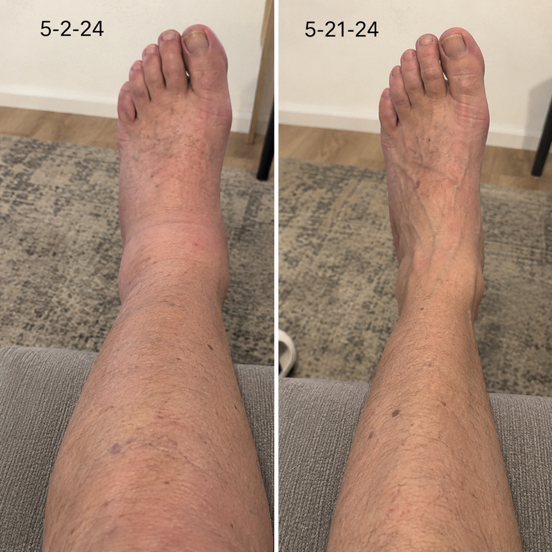 using Curverapro less than 8 weeks