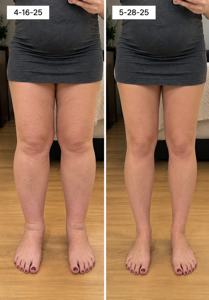 using Curverapro less than 8 weeks