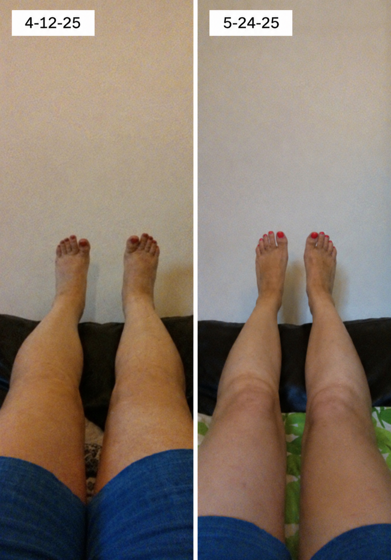 using Curverapro less than 8 weeks