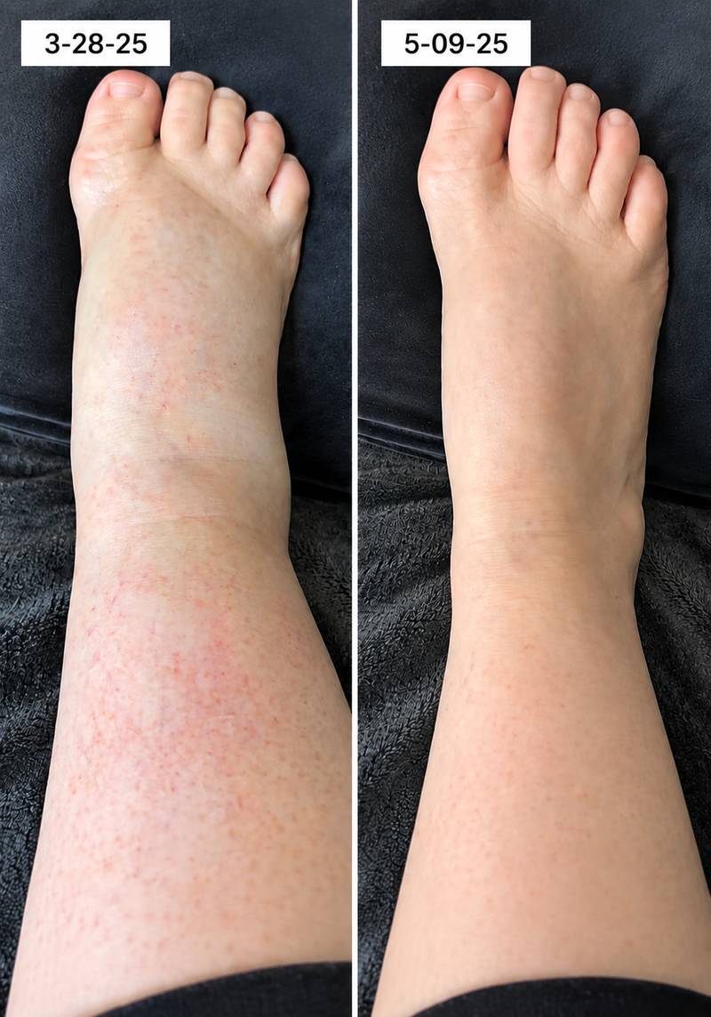 using Curverapro less than 8 weeks
